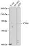 Sodium Voltage-Gated Channel Alpha Subunit 8 antibody, 13-368, ProSci, Western Blot image 