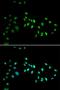 DNA Methyltransferase 3 Alpha antibody, LS-C332396, Lifespan Biosciences, Immunofluorescence image 