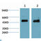 SMAD Family Member 3 antibody, LS-C813729, Lifespan Biosciences, Western Blot image 