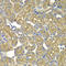 Proteasome 26S Subunit, Non-ATPase 5 antibody, LS-C348997, Lifespan Biosciences, Immunohistochemistry paraffin image 