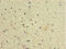 General Transcription Factor IIH Subunit 5 antibody, A54684-100, Epigentek, Immunohistochemistry paraffin image 