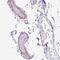 EMAP Like 5 antibody, PA5-62898, Invitrogen Antibodies, Immunohistochemistry frozen image 
