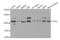 Integrin Subunit Alpha L antibody, abx001384, Abbexa, Western Blot image 