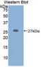 Serine Protease 2 antibody, LS-C296077, Lifespan Biosciences, Western Blot image 