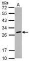 Major Histocompatibility Complex, Class II, DQ Beta 2 antibody, GTX104461, GeneTex, Western Blot image 
