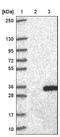 Cysteine Rich Secretory Protein 2 antibody, NBP1-85452, Novus Biologicals, Western Blot image 