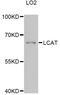 Lecithin-Cholesterol Acyltransferase antibody, abx126084, Abbexa, Western Blot image 