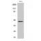 Casein Kinase 2 Alpha 1 antibody, LS-C382441, Lifespan Biosciences, Western Blot image 