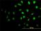 Senataxin antibody, H00023064-M05, Novus Biologicals, Immunofluorescence image 