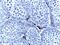 Cytochrome P450 Family 17 Subfamily A Member 1 antibody, NBP2-01151, Novus Biologicals, Immunohistochemistry frozen image 