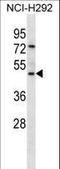 Glycoprotein 2 antibody, LS-B11222, Lifespan Biosciences, Western Blot image 