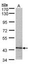 Proteasome 26S Subunit, ATPase 6 antibody, GTX104314, GeneTex, Western Blot image 