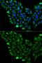 Short-chain specific acyl-CoA dehydrogenase, mitochondrial antibody, GTX55489, GeneTex, Immunocytochemistry image 