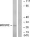 MAS Related GPR Family Member E antibody, LS-C120743, Lifespan Biosciences, Western Blot image 