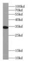 Interleukin 22 Receptor Subunit Alpha 2 antibody, FNab04255, FineTest, Western Blot image 
