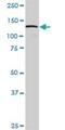 DEAD-Box Helicase 42 antibody, H00011325-B01P, Novus Biologicals, Western Blot image 