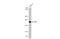 GLI Family Zinc Finger 1 antibody, GTX635619, GeneTex, Western Blot image 