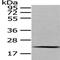 Mediator Complex Subunit 18 antibody, PA5-51305, Invitrogen Antibodies, Western Blot image 