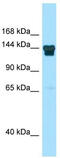 ADNP Homeobox 2 antibody, TA343760, Origene, Western Blot image 