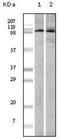 EPH Receptor A1 antibody, abx010718, Abbexa, Enzyme Linked Immunosorbent Assay image 