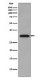 Cyclin Dependent Kinase 2 antibody, M00166, Boster Biological Technology, Western Blot image 