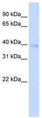 Homeobox A11 antibody, TA344430, Origene, Western Blot image 