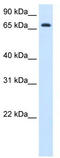 Histidine Ammonia-Lyase antibody, TA338258, Origene, Western Blot image 