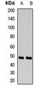 Inositol Polyphosphate-5-Phosphatase A antibody, LS-C667665, Lifespan Biosciences, Western Blot image 