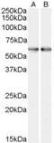Smoothened, Frizzled Class Receptor antibody, PA5-18585, Invitrogen Antibodies, Western Blot image 