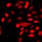 RNF36 antibody, LS-C668937, Lifespan Biosciences, Immunofluorescence image 