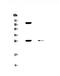 BCL2 antibody, A00040-2, Boster Biological Technology, Western Blot image 