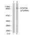 Signal Transducer And Activator Of Transcription 5A antibody, orb7021, Biorbyt, Western Blot image 