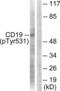 CD19 antibody, LS-C198754, Lifespan Biosciences, Western Blot image 