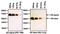 Estrogen Receptor 1 antibody, PA1-308, Invitrogen Antibodies, Western Blot image 