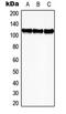 EPH Receptor B3 antibody, LS-C353724, Lifespan Biosciences, Western Blot image 