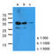 Kallikrein Related Peptidase 3 antibody, LS-B8973, Lifespan Biosciences, Western Blot image 
