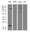 HECT Domain And Ankyrin Repeat Containing E3 Ubiquitin Protein Ligase 1 antibody, LS-C795247, Lifespan Biosciences, Western Blot image 