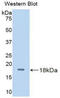 Beta-N-Acetylglucosaminidase antibody, LS-C299935, Lifespan Biosciences, Western Blot image 