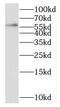 Scm Polycomb Group Protein Homolog 1 antibody, FNab07638, FineTest, Western Blot image 