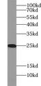 Ubiquitin Conjugating Enzyme E2 K antibody, FNab09178, FineTest, Western Blot image 