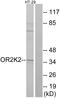 Olfactory Receptor Family 2 Subfamily K Member 2 antibody, GTX87658, GeneTex, Western Blot image 
