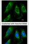 Phosphoglycerate Kinase 1 antibody, PA5-28612, Invitrogen Antibodies, Immunofluorescence image 