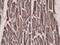 Acetyl-CoA Carboxylase Alpha antibody, M01802-1, Boster Biological Technology, Immunohistochemistry paraffin image 