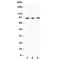 FER Tyrosine Kinase antibody, R30982, NSJ Bioreagents, Western Blot image 