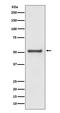 TNF receptor-associated factor 2 antibody, M00400, Boster Biological Technology, Western Blot image 