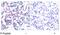 JunB Proto-Oncogene, AP-1 Transcription Factor Subunit antibody, GTX79027, GeneTex, Immunohistochemistry paraffin image 