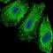 Forkhead Box O1 antibody, GTX60558, GeneTex, Immunofluorescence image 