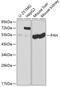 Phenylalanine Hydroxylase antibody, 16-123, ProSci, Western Blot image 