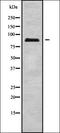 ERCC Excision Repair 2, TFIIH Core Complex Helicase Subunit antibody, orb337872, Biorbyt, Western Blot image 