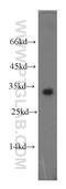 C-Type Lectin Domain Family 2 Member D antibody, 13188-1-AP, Proteintech Group, Western Blot image 